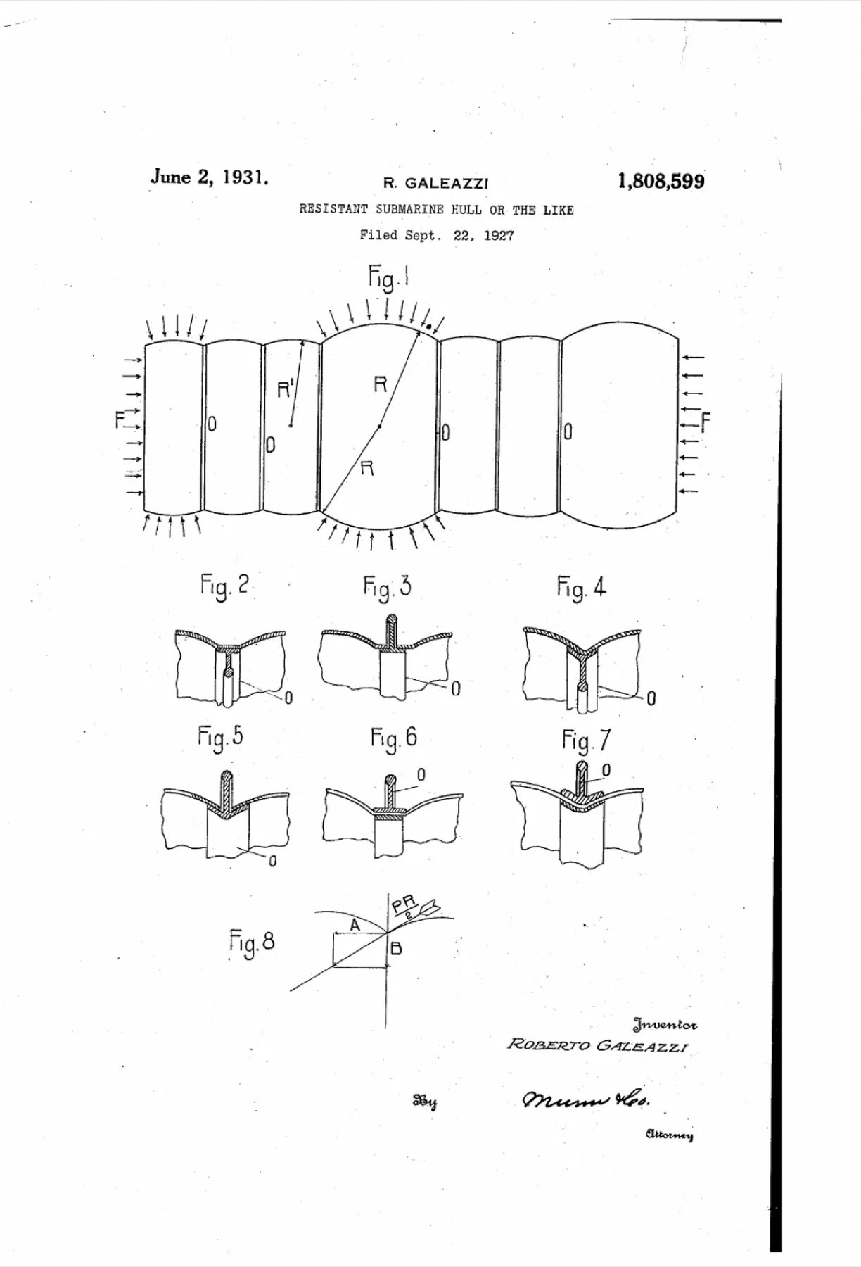 Galeazzi patent